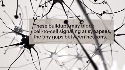 What are Beta-Amyloids plaques?