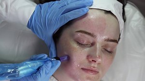 25K views · 109 reactions | *New Treatment Alert* After 6 months of training in Ireland & in Serbia, we are excited to introduce an amazing new technique of Micro Needling. And the great news is, Up To My Eyes are offering this astonishing facial at a price of €125 per treatment!!! Has to be experienced to be believed :) ... The transformation of your skin will amaze you! Listen up to hear what #aislingkelly.com has to say about it! 012872781 | Up To My Eyes | Facebook