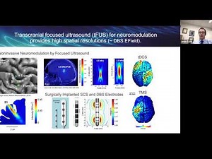 Neuroengineering Methods and Devices for Enhancing Plasticity and Brain Health