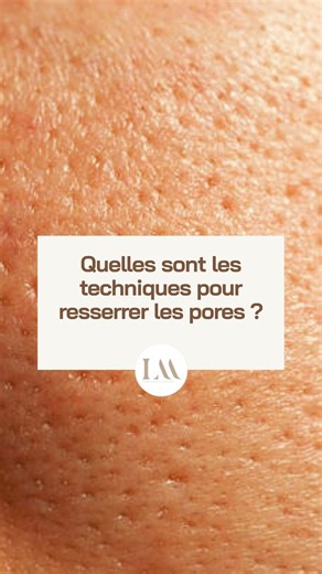Dr Elena Romanova on Instagram: "💘 Une peau lisse pour la Saint-Valentin À l’approche de la Saint-Valentin, beaucoup souhaitent une peau plus uniforme, lumineuse et douce au toucher. Les pores dilatés sont souvent liés à une perte de fermeté cutanée, à un excès de sébum ou au vieillissement progressif de la peau. Il ne s’agit pas de les « fermer », mais de renforcer la structure cutanée pour qu’ils deviennent moins visibles et que la peau retrouve une texture plus régulière. Deux approches médi
