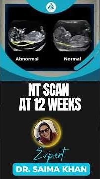 What is NT Scan :Technique and Clinical Importance #health #ultrasound #medical # ⁨@Dr.Saimakhan