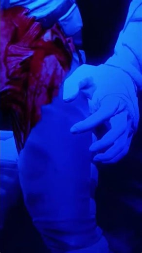 Sub zero Xray johnny cage Xray. cyber sub zero Xray smoke x ray cyrax Xray