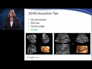 Quick Concepts - 3D 4D Acquisition