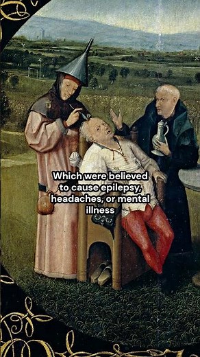 Ancient Neurosurgery looks a bit gnarly | The History of Trephination (Trepanning) #archaeology