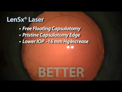 Alcon LenSx® Laser Cataract Surgery