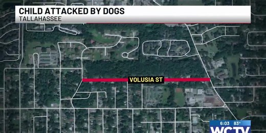 Child attacked by dogs in Tallahassee