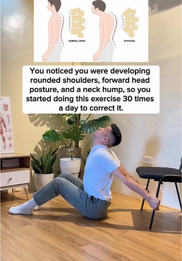 Effective Posture Exercises to Correct Bad Posture
