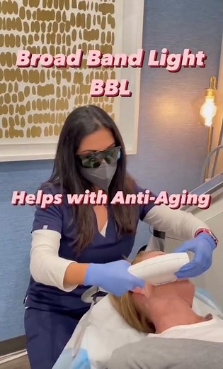Broad Band Light (BBL) | The Bay Area's Top Laser Treatment For The Face