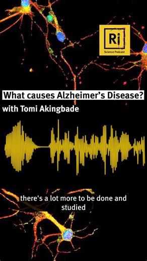 New podcast episode 🎧 Alzheimer’s Disease is caused by the excessive build-up of proteins in the brain. Neuroscientist Tomi Akingbade explains how inflammation could be playing a role in the progression of Alzheimer’s, and what this could mean for future research. Listen now: shows.acast.com/ri-science-podcast/episodes/the-role-of-inflammation-in-alzheimers-disease-with-tomi-aki | Royal Institution of Great Britain