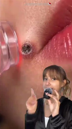 ¡Arcilla Volcánica para Piel Perfecta!