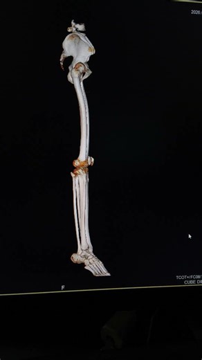 CT ANGIOGRAPHY LOWER LIMBS ☢️. #anatomy #ct #ctscan
