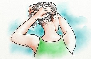 Do Fungal Infections Cause Hair Loss? - Hairguard