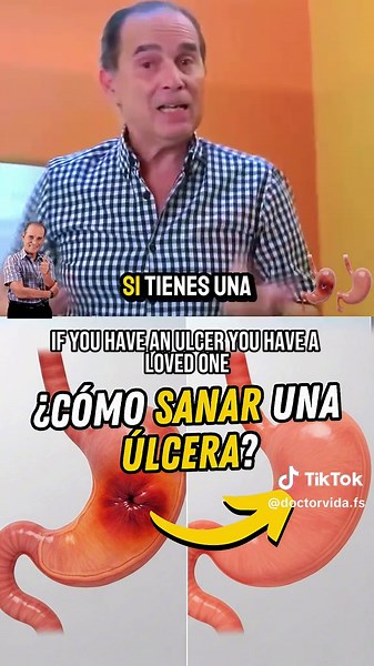 Cómo sanar una úlcera: tratamiento y síntomas claves