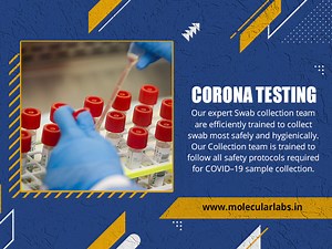 What is RTPCR Testing