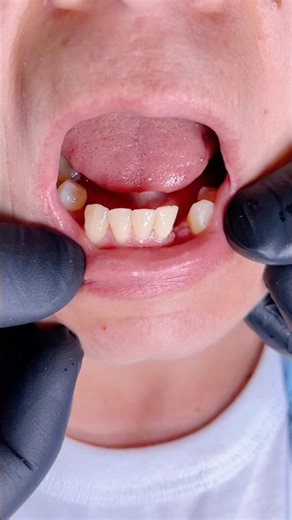 Prótesis dentales MrDent