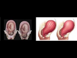 MINI LESSON 002: The Uterus in Action