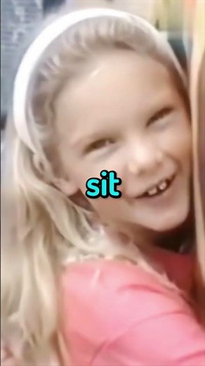 Taylor Swift Leg SCAR Story 😳