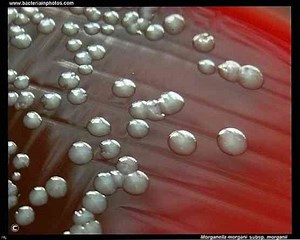 Morganella morganiiの特徴、病気、治療 / 生物学