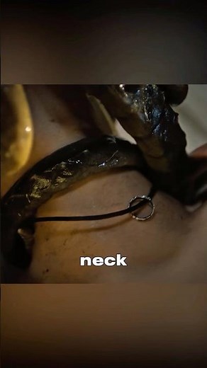 [PART 4] Facehugger Crisis, Life and Death Choice