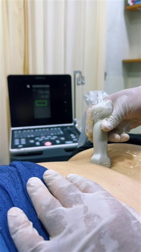 ¿Sabías que el ozono puede ayudar a tu cuerpo a regenerarse? La ozonoterapia mejora oxigenación, circulación y bienestar. Resultados reales, atención médica especializada. #cix #bienestar #medicina #salud#ozonoterapia