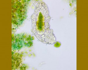 89K views · 680 reactions | Water bears are known for putting up with some extreme conditions, but even they have their limits. Those limits being prolonged exposure in the vacuum of space. 匿 by @tardibabe/IG #science #microscopic | Science Channel | Facebook