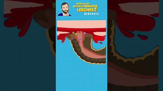 The Worst Ways to Remove a Leech (And What Actually Works)