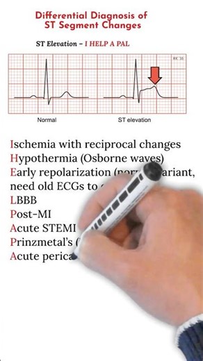Diferential Diagnosis of ST Segment Changes