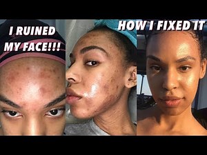 How I healed my damaged skin: My honest skincare journey & transformation