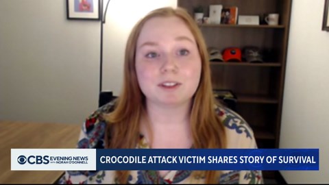 Crocodile attack victim shares story of survival