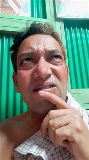 ডাক্তার আমার সামনে দাঁত গুলো নোংরা হয়ে গেছে #Bijoy Blogs#comedy #viral #sorts #arunkarmoker