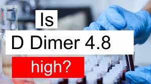 Is D Dimer 4.8 high, normal or dangerous? What does D Dimer level 4.8 mean?
