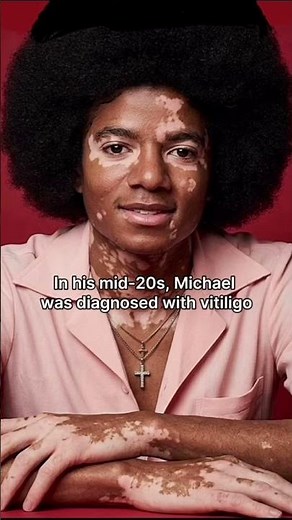 The Truth Behind Michael Jackson's Skin Color Change