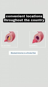 15 shares |  If you're 40 or older get screened for Heart Disease and Stroke Risk. Schedule your appointment today. | Life Line Screening | Facebook