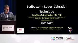 Reduction Technique for Severe SCFE