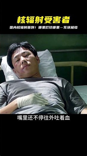 China's first nuclear radiation victim, who had organs removed from areas that were rotting, ulti...