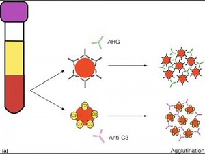 Agglutination Types ; Direct Agglutination, Indirect Agglutination, Passive Agglutination