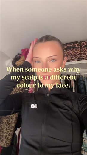 Understanding Scalp and Face Color Differences