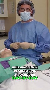 Live Face Lift & Blepharoplasty_ Watch the Transformation