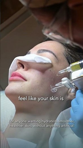 Platelet Mesotherapy (PRP Facial) Experience | Natural Skin Rejuvenation at Clinique de Paris #prp