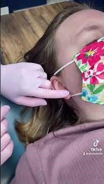 Stretching ears from 8g to 6g