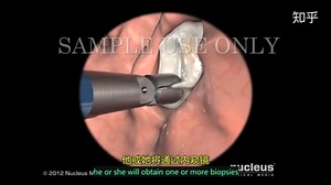 3D医学演示：胃镜检查（中英双字幕+原版英文）