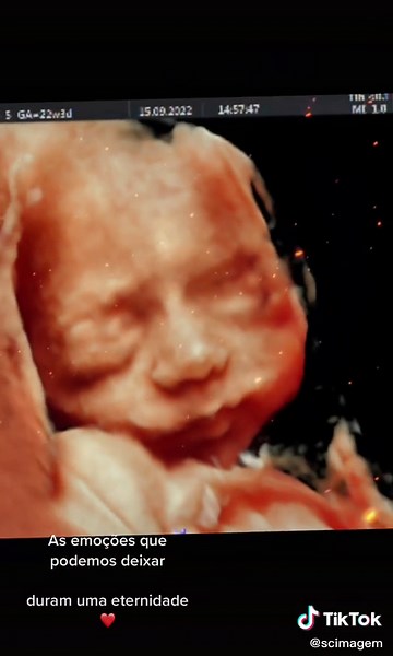 Human Fetus Development Stages in the Womb