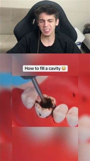 Root Canal Treatment Procedure!