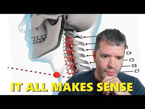 Charlie Kirk "Magic Bullet" Explained❗