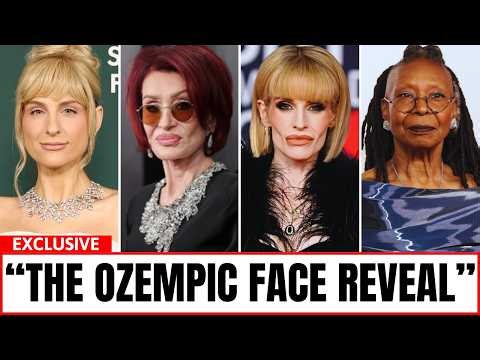 15 Shocking Ozempic Celebrity Transformations You Can’t Unsee | Then and Now 2026