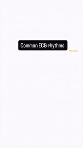 Most common ECGs #ECG #EKG #criticalcare #education #simulation | Moayad Wishah