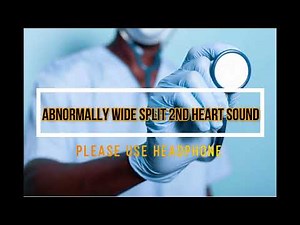 ABNORMALLY WIDE SPLIT SECOND HEART SOUNDS| S2
