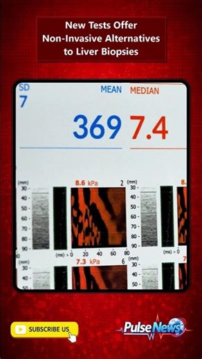 New Tests Offer Non-Invasive Alternatives to Liver Biopsies