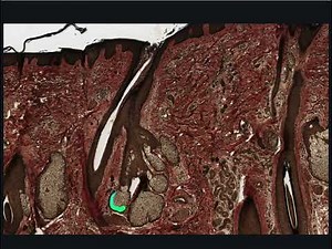 The Integumentary System (Skin) - Sebaceous Gland