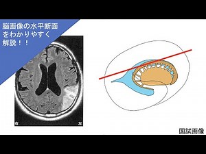 【脳画像の見方（水平断面編）＃0】脳の解剖・生理学について CT MRI 理学療法士国家試験・作業療法士国家試験編 PT・OT・ST・看護師 ＃国試 ＃国家試験